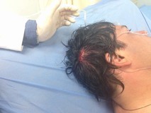 Herido en la cabeza por la represión diputado Carlos Paparon...