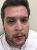Agredido Diputado del Parlasur Eudoro González por grupos ar...