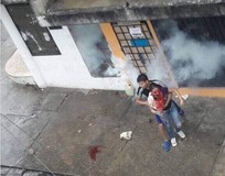 Militante de Primero Justicia fue herida en la cara con perd...