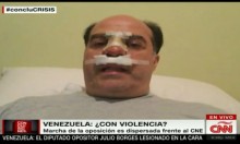 Julio Borges: "No hay manera en que no haya referendo r...