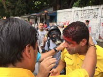 El diputado José Manuel Olivares fue herido en la cabeza por...